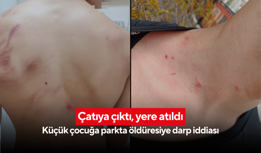 Çatıya çıktı, yere atıldı: Küçük çocuğa parkta öldüresiye darp iddiası