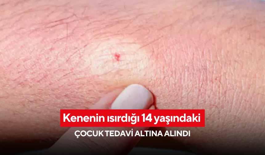 Kenenin ısırdığı 14 yaşındaki çocuk tedavi altına alındı