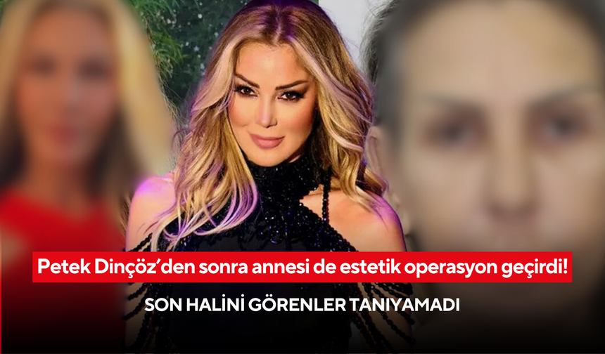 Petek Dinçöz’den sonra annesi de estetik operasyon geçirdi! Son halini görenler tanıyamadı