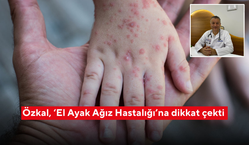 Özkal, ‘El Ayak Ağız Hastalığı’na dikkat çekti