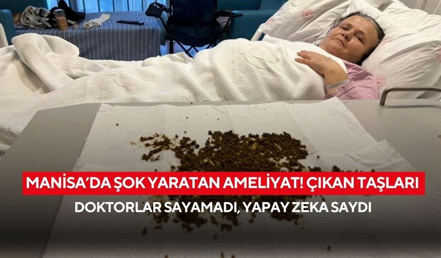 Manisa’da şok yaratan ameliyat! Çıkan taşları doktorlar sayamadı, yapay zeka saydı