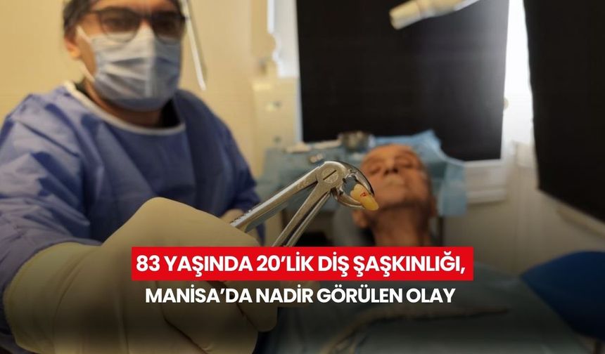 83 yaşında 20’lik diş şaşkınlığı, Manisa’da nadir görülen olay