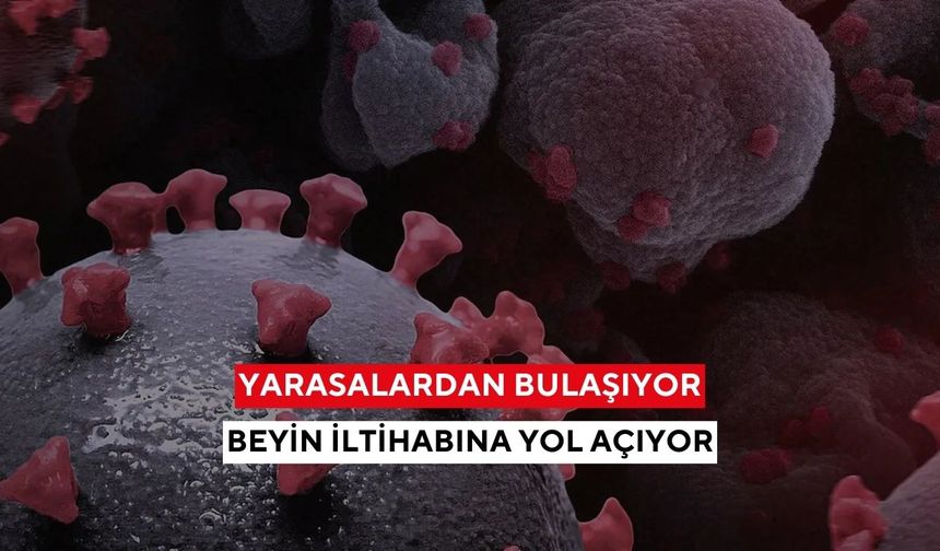 Sessiz başlıyor, hızla öldürüyor! Ölüm oranı %75'e varan Nipah virüsü alarmı!