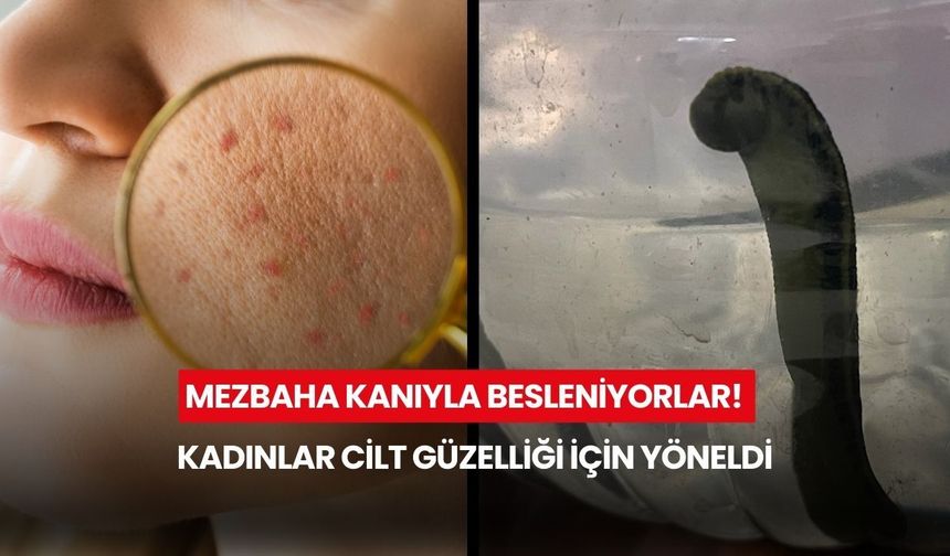 Mezbaha kanıyla besleniyorlar! Kadınlar cilt güzelliği için yöneldi