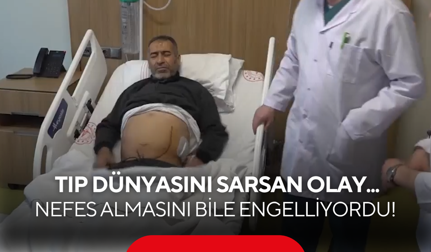Tıp dünyasını sarsan olay! Tam 8 kilo ağırlığında, 50 santim boyunda...