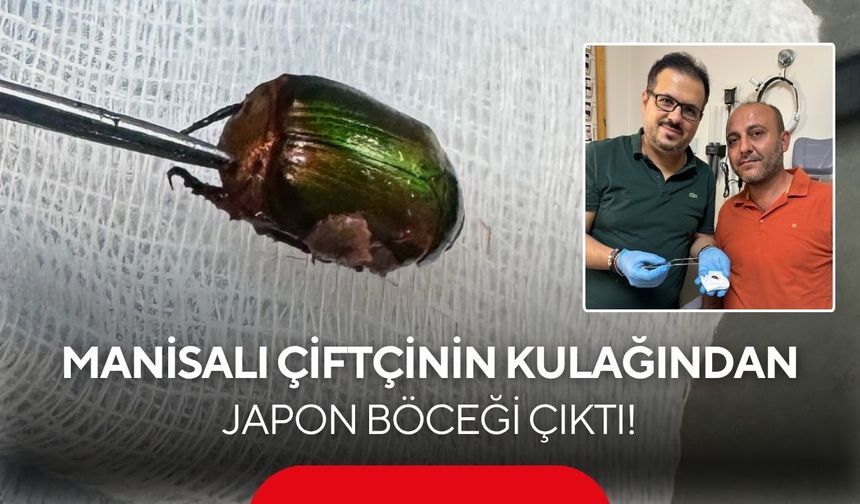 Çiftinin kulağındaki Japon Böceği Salihli’de çıkarıldı