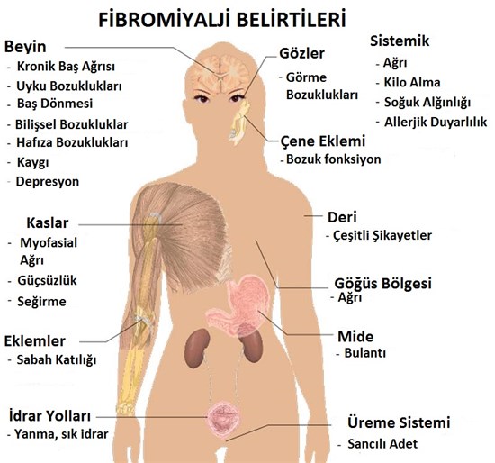 fibromiyalji-nedir