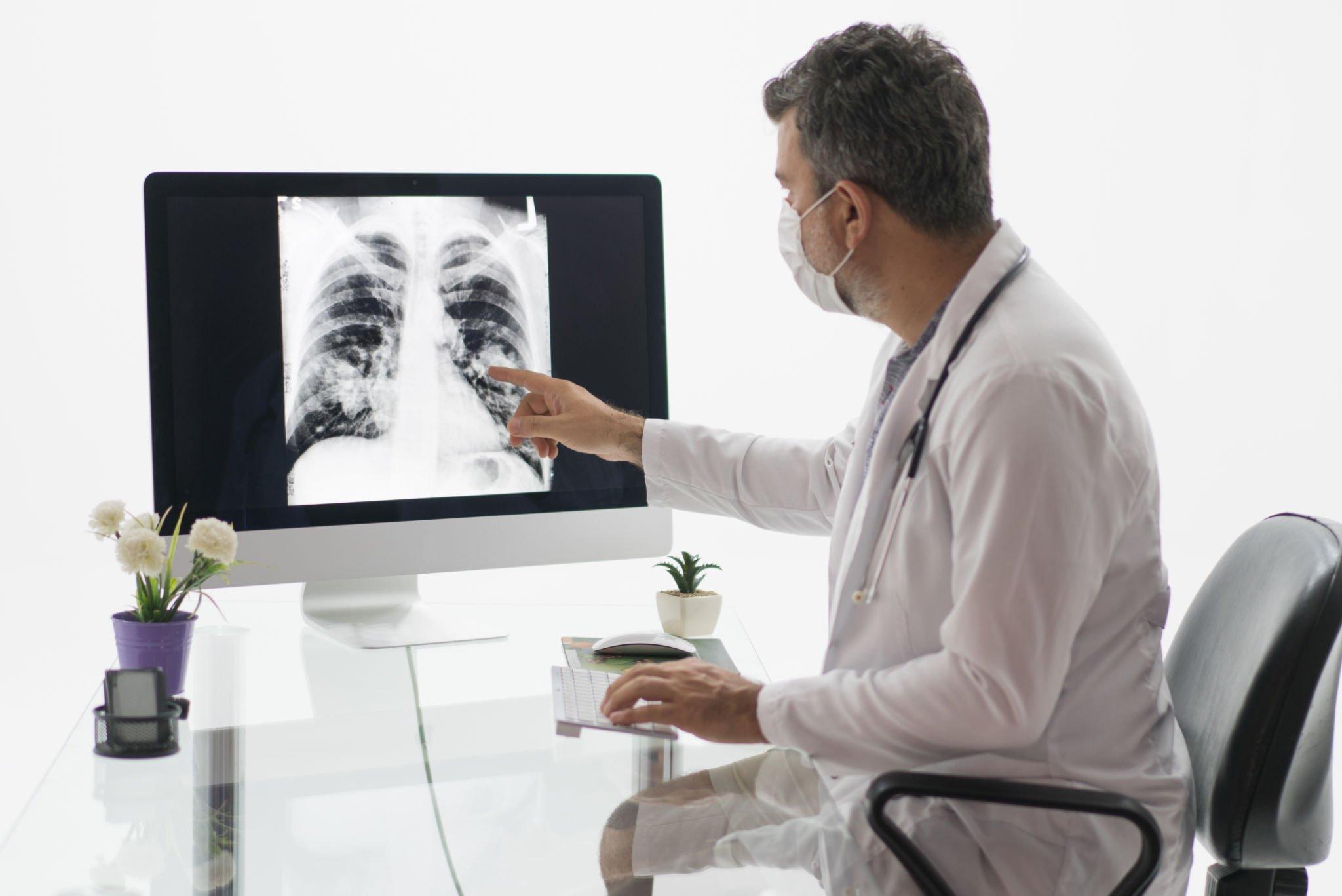 Radyoloji Uzmani Maaslari 3