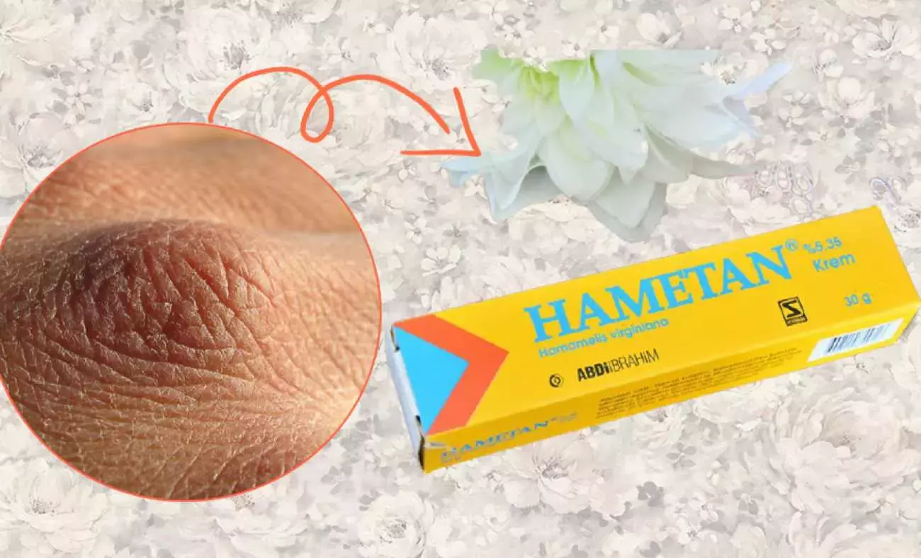 Hametan Krem Nedir, Ne İşe Yarar (1)-2