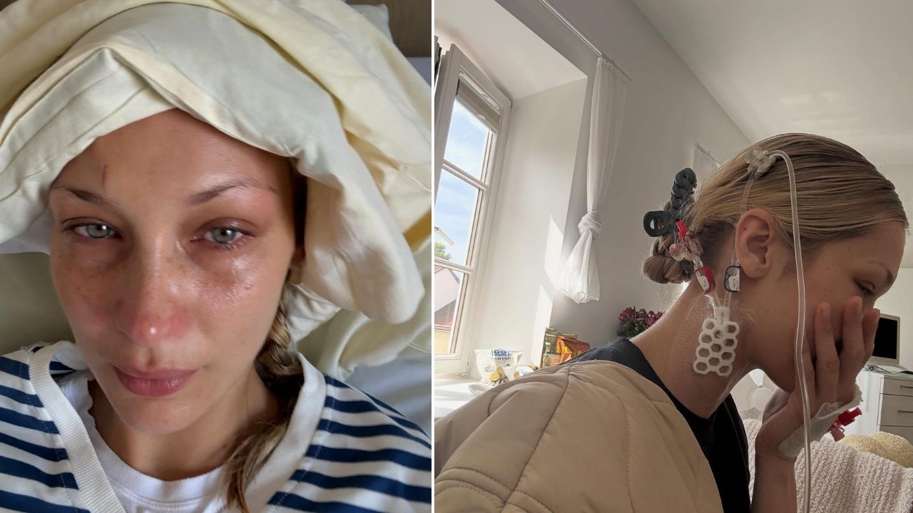 Bella Hadid Lyme Hastaligi Ile Mucadele Ediyor