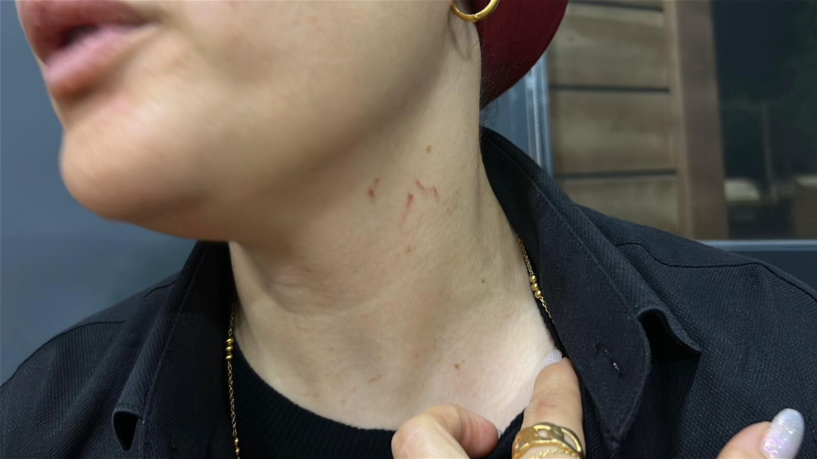 Düğünde Korku Dolu Anlar Halay Başı Olmak Isteyen Şahıs Soliste Saldırdı! (5)