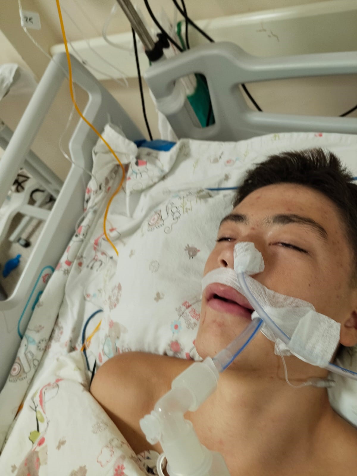 Lisede Kan Donduran Saldırı 14 Yaşındaki Öğrenci Akranı Tarafından Öldüresiye Darbedildi (2)