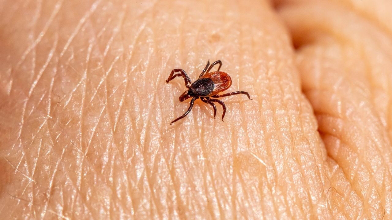 Lyme Hastaligi Nasil Bulasir