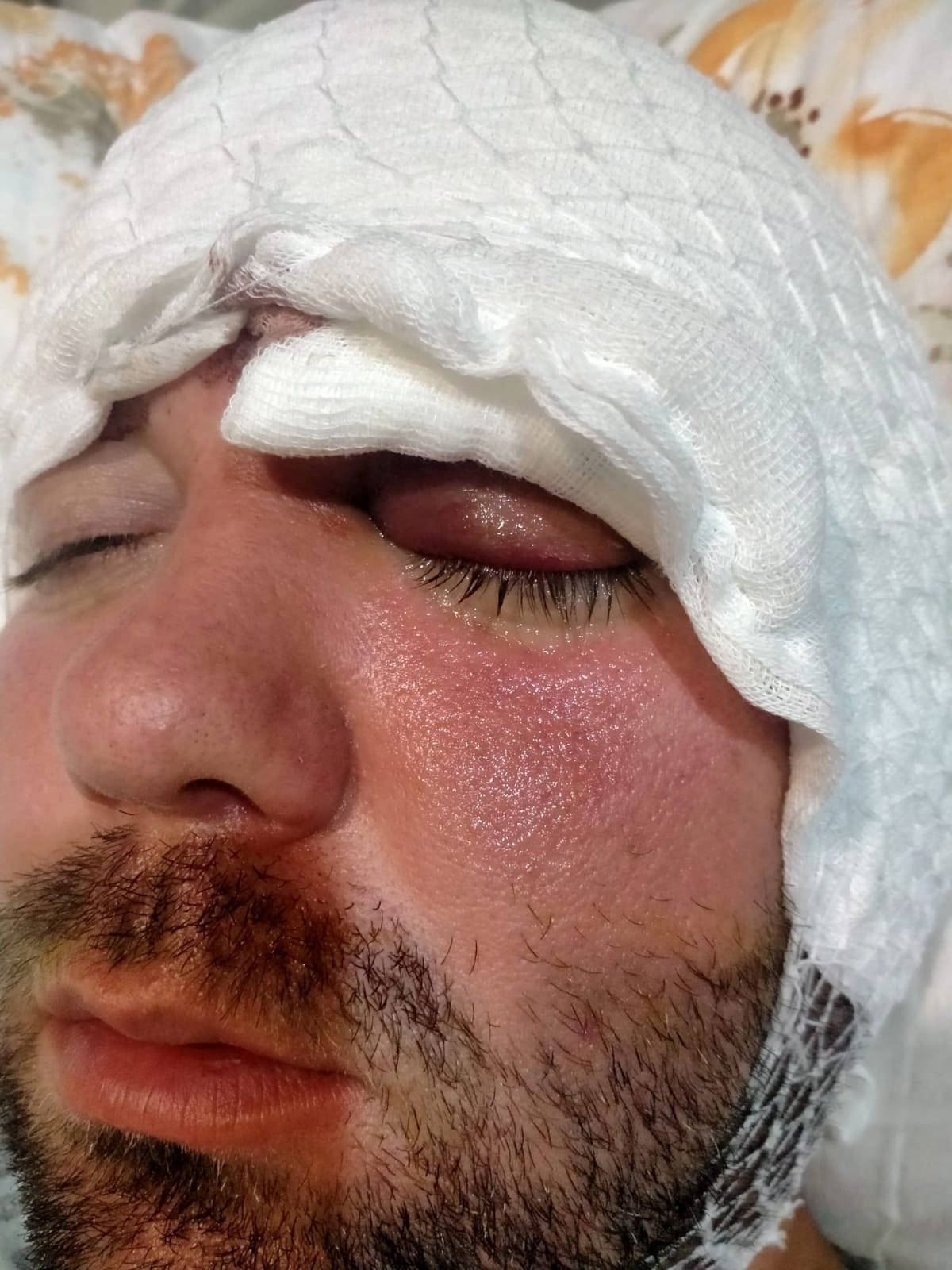 Bir Vida, Bir Ömürlük Acı Ramazan Yılmaz’ın Bitmeyen Adalet Mücadelesi! (3)