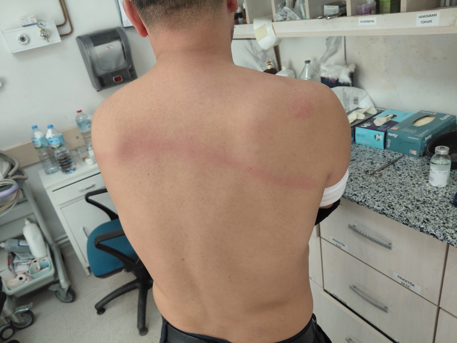 Chp’li Başkana Şok Suçlama Zabıta Dayağı, Silahlı Saldırı Ve Mobing Iddiası! (8)