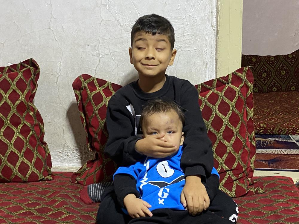 Eskisehirde Ameliyatla Gelen Mucize (3)