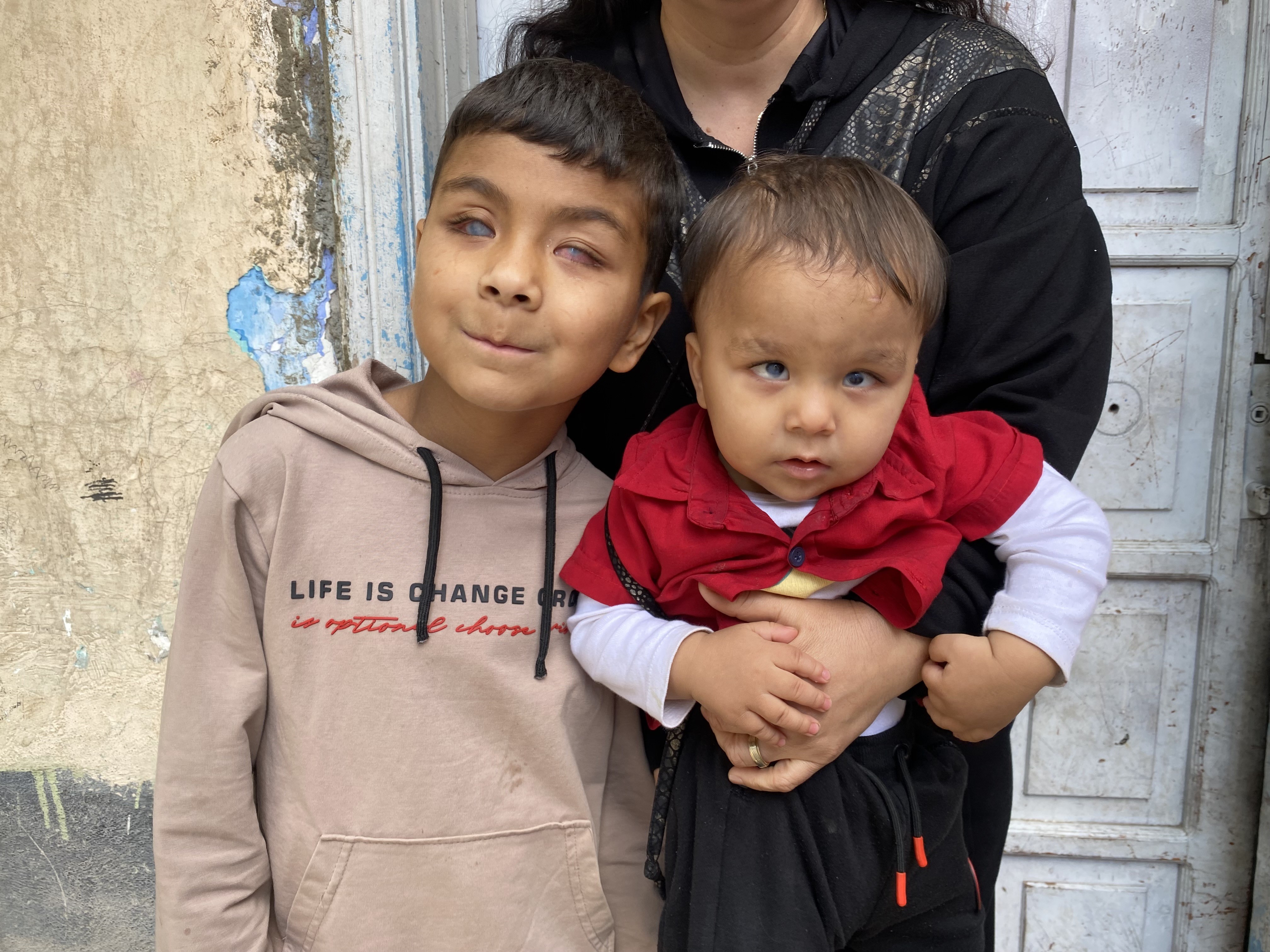 Kardeşlerin Mucizevi Dönüşü Görme Engelini Aşıp Yeni Bir Hayata Başladılar (8)