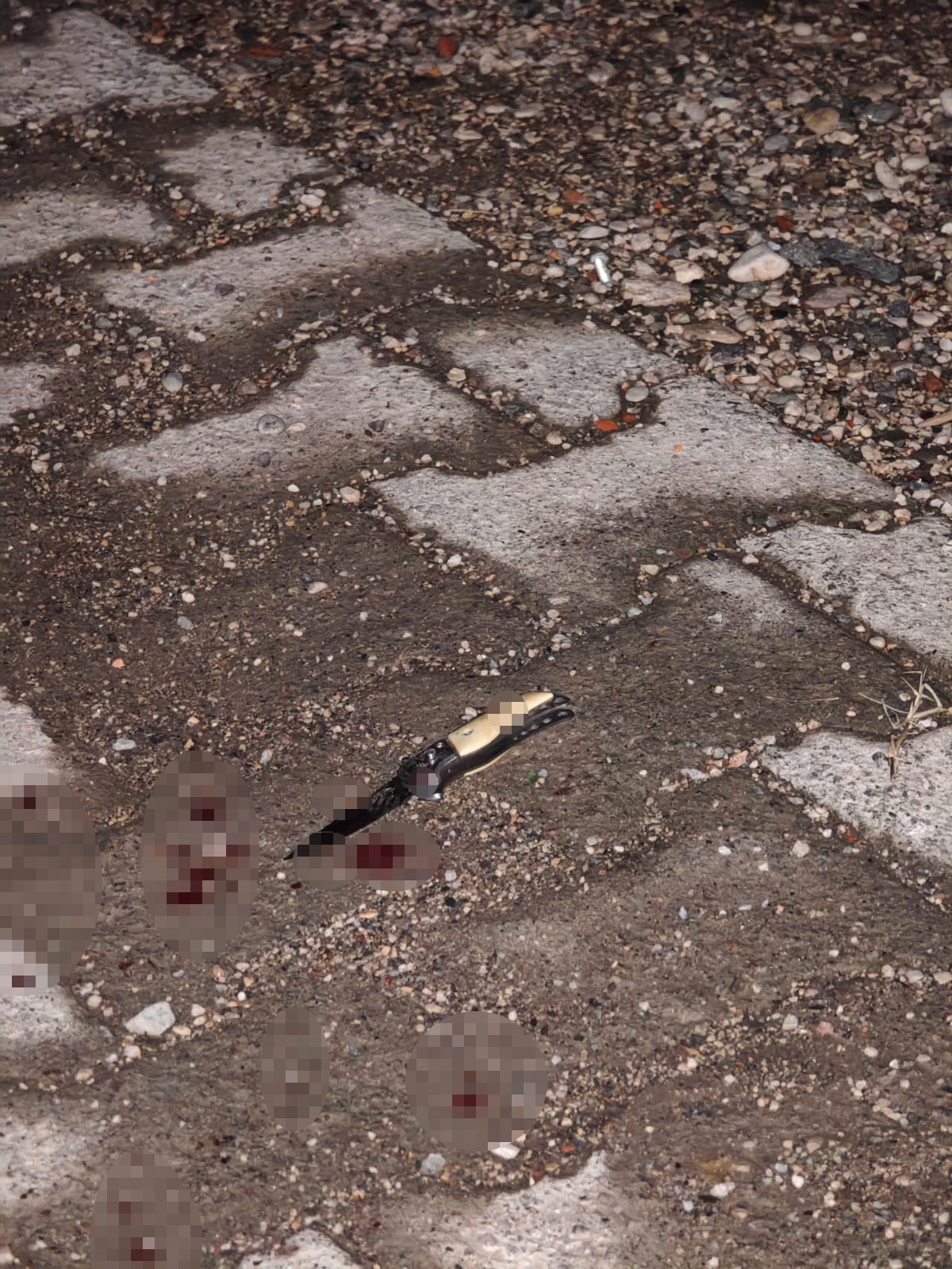 Kız Yüzünden Çıkan Tartışma Bıçaklı Saldırıya Dönüştü 16 Yaşındaki Genç Ölümle Pençeleşiyor (2)