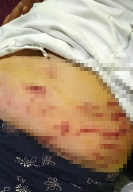 Köpek Dehşeti Sosyal Medyada Gündem Oldu Kadın Ve Kuryeyi Parçaladı, O Anlar Kamerada (2)