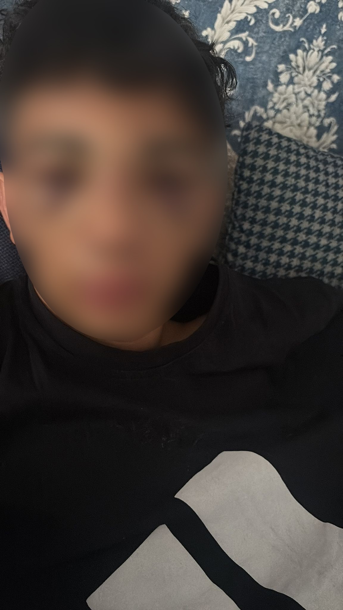 Okul Arkadaşının Daveti Kabus Oldu 14 Yaşındaki Çocuğun Yüzü Tanınmayacak Hale Geldi (2)