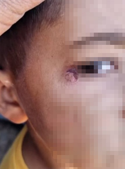 Okulda Akıl Almaz Şiddet Öğrenciyi Dövüp Yüzünde Sigara Söndürdü (2)