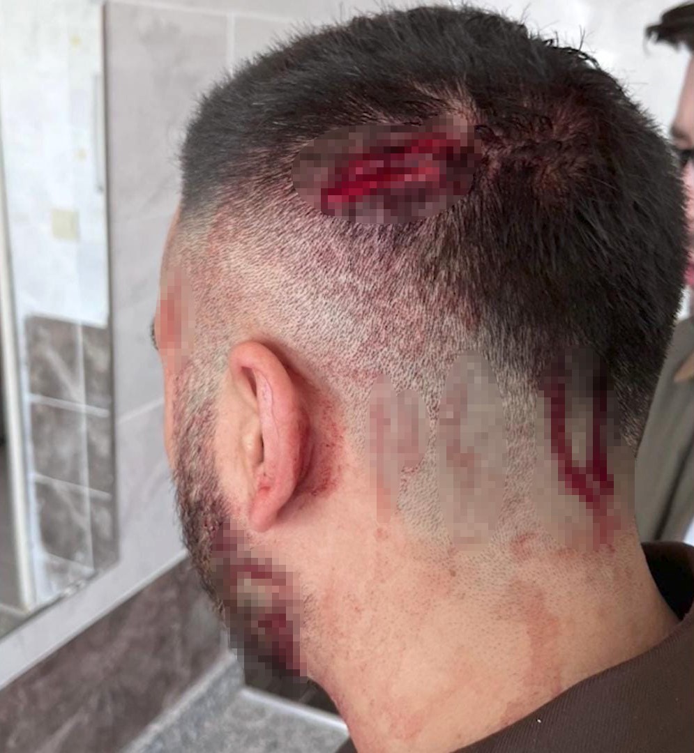 Okulda Degil Savas Alaninda Gibi Veli Ogretmeni Sopayla Hastanelik Etti (1)-1