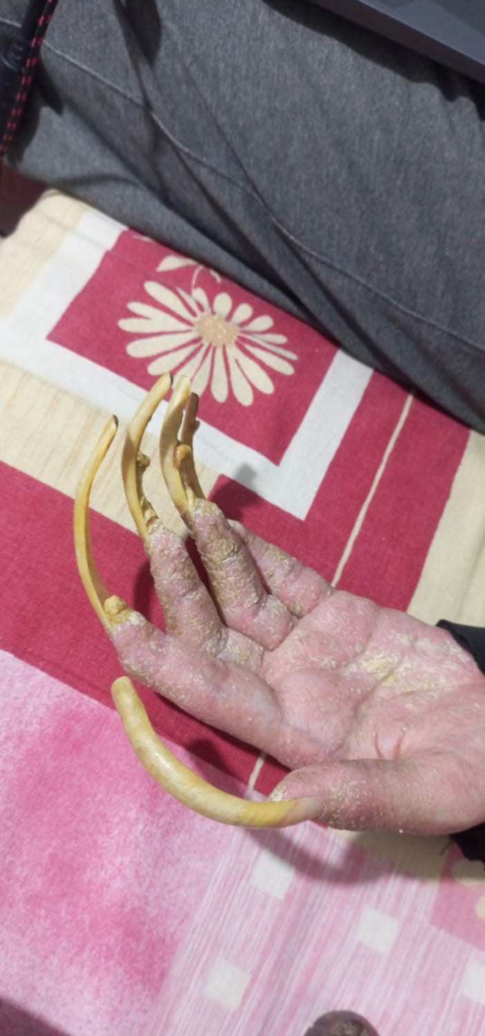 Üç Yıldır Ne Dışarı Çıktı Ne De Banyo Yaptı “Öleceğim” Diyen 23 Yaşındaki Genç, Hayattan Umudunu Kesti (2)