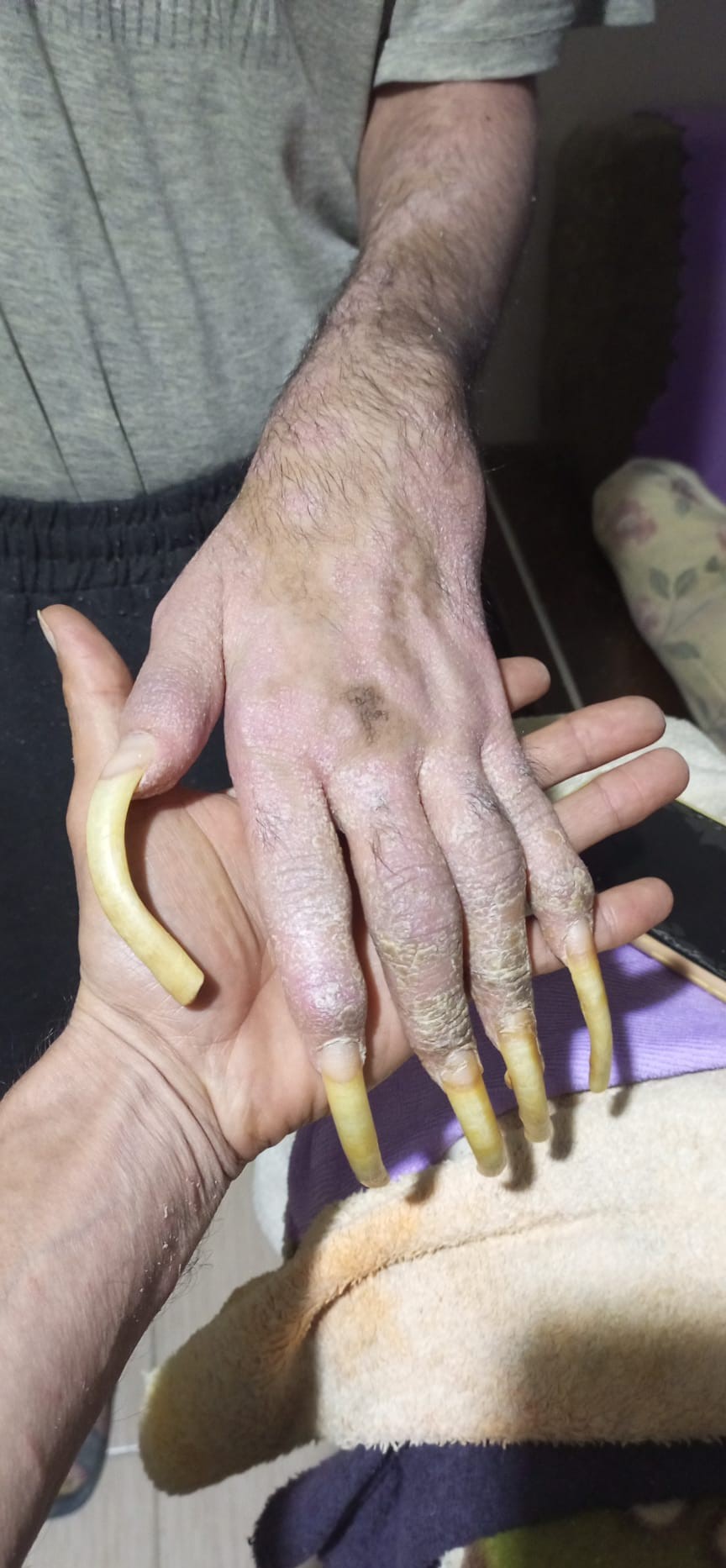 Üç Yıldır Ne Dışarı Çıktı Ne De Banyo Yaptı “Öleceğim” Diyen 23 Yaşındaki Genç, Hayattan Umudunu Kesti (3)