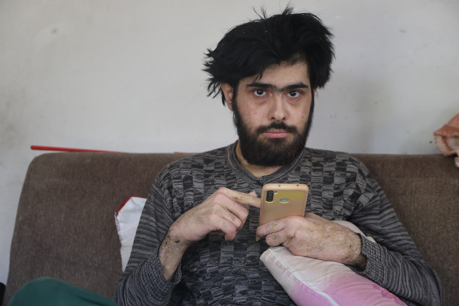 Üç Yıldır Ne Dışarı Çıktı Ne De Banyo Yaptı “Öleceğim” Diyen 23 Yaşındaki Genç, Hayattan Umudunu Kesti (4)