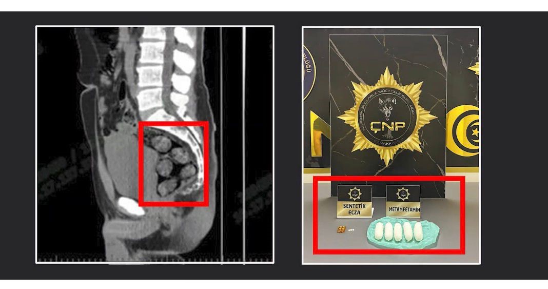 Uyuşturucuyu Yutup Türkiye’ye Getirdi! Narkotik Ekiplerinden Film Gibi Operasyon (9)