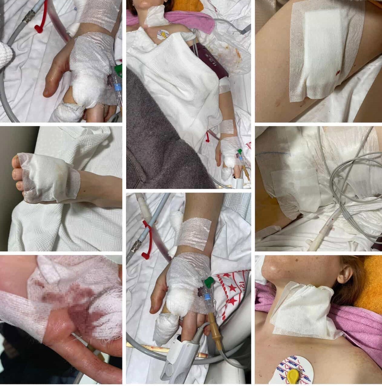 Uzaklaştırma Talebi Sonuç Vermedi Eski Koca 11 Bıçak Darbesiyle Saldırdı (2)