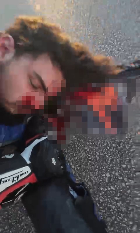 Virajı Alamayan Genç Motosikletçi 25 Gün Sonra Hayatını Kaybetti! Kaza Anı Kamerada… (3)