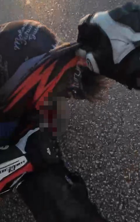 Virajı Alamayan Genç Motosikletçi 25 Gün Sonra Hayatını Kaybetti! Kaza Anı Kamerada… (6)