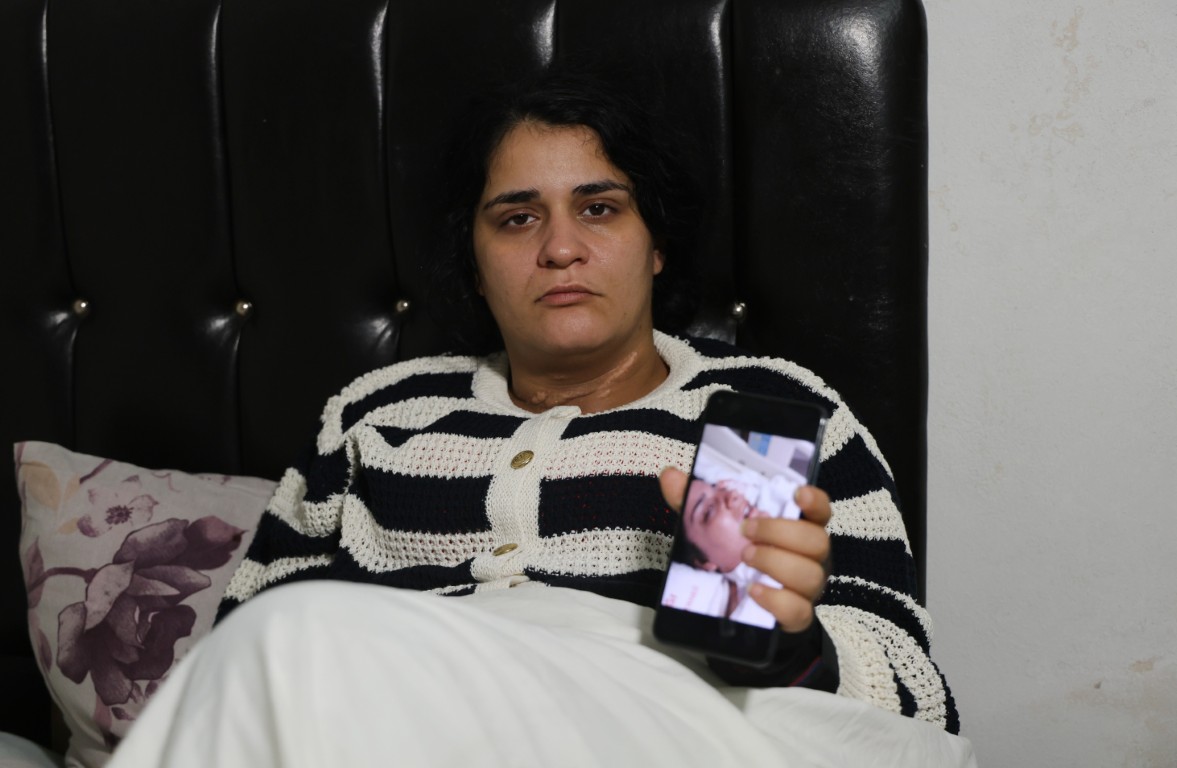 29 Yasindaki Anne Eski Esi Tarafindan Bicaklandi 45 Aylik Tedavi Surecinin Ardindan Ye (1) (Orta)