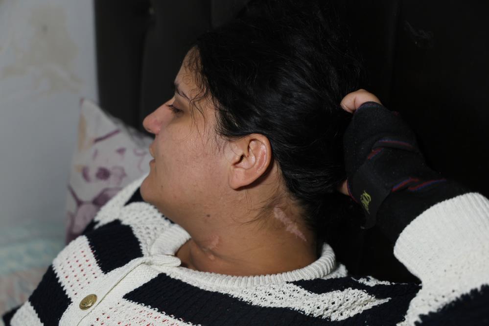 29 Yasindaki Anne Eski Esi Tarafindan Bicaklandi 45 Aylik Tedavi Surecinin Ardindan Ye