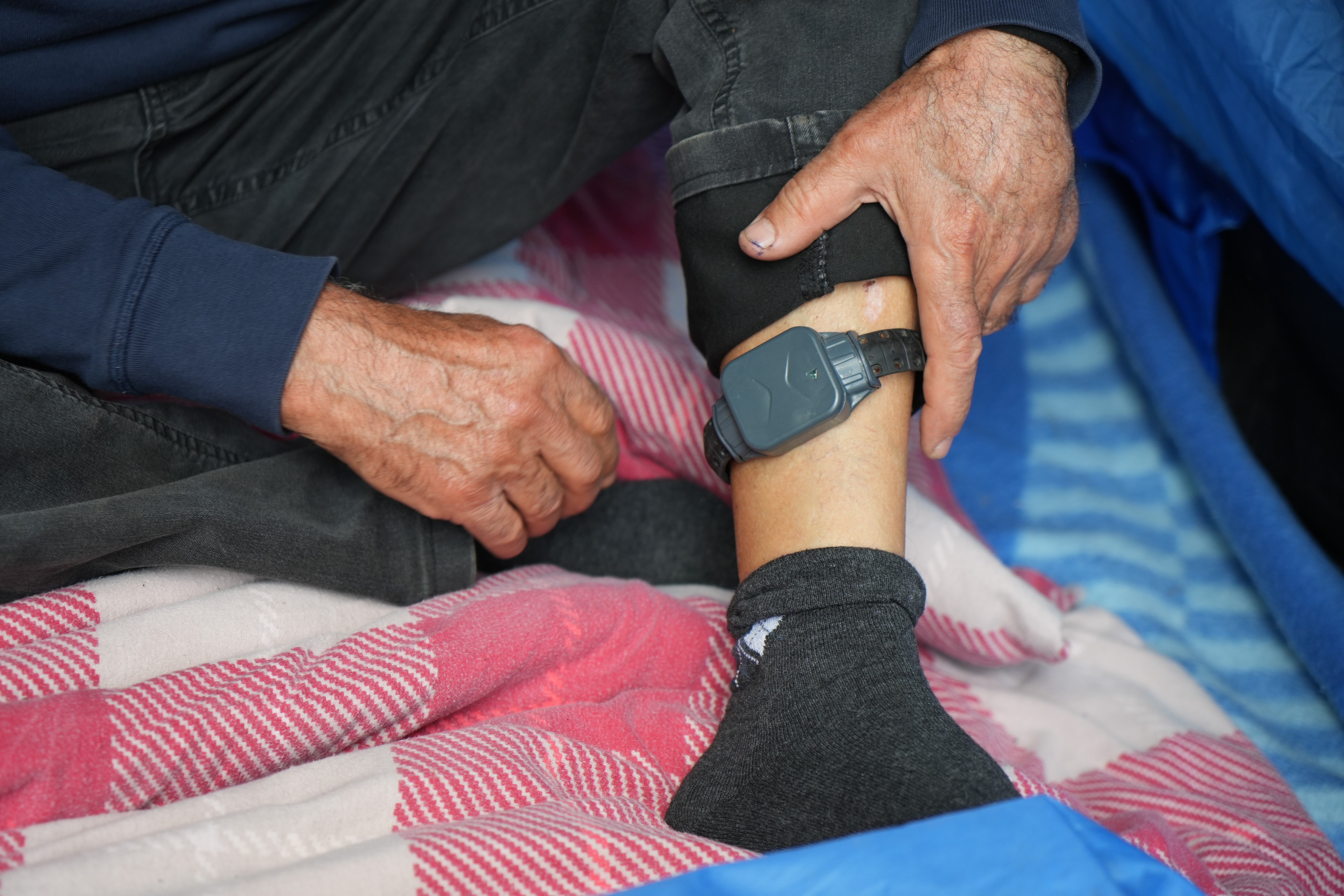 Affettiği Eşi Hayatını Kararttı Eşi Tarafından Bıçaklandı, Affetti, Şimdi Çadırda Yaşıyor (3)