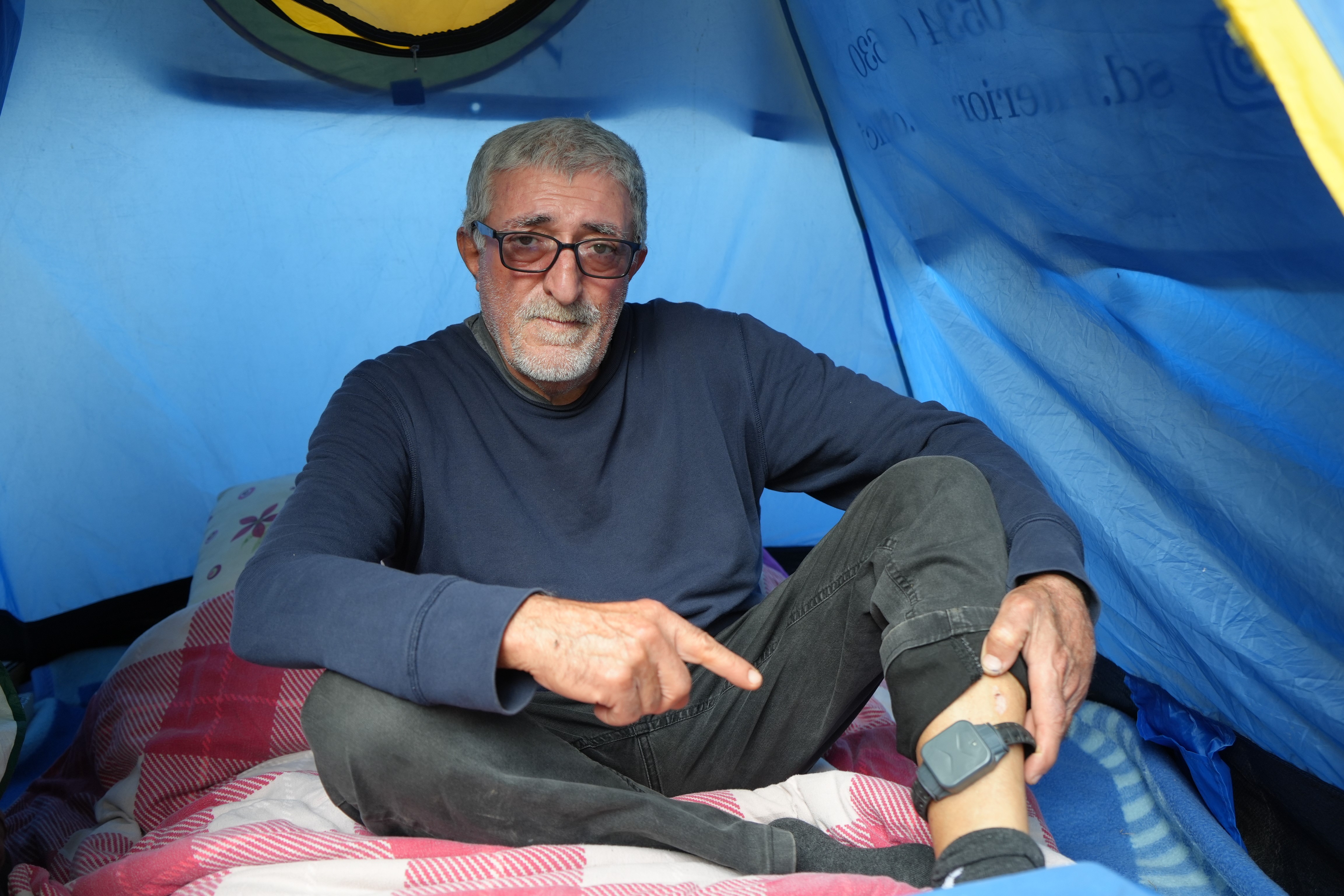 Affettiği Eşi Hayatını Kararttı Eşi Tarafından Bıçaklandı, Affetti, Şimdi Çadırda Yaşıyor (8)