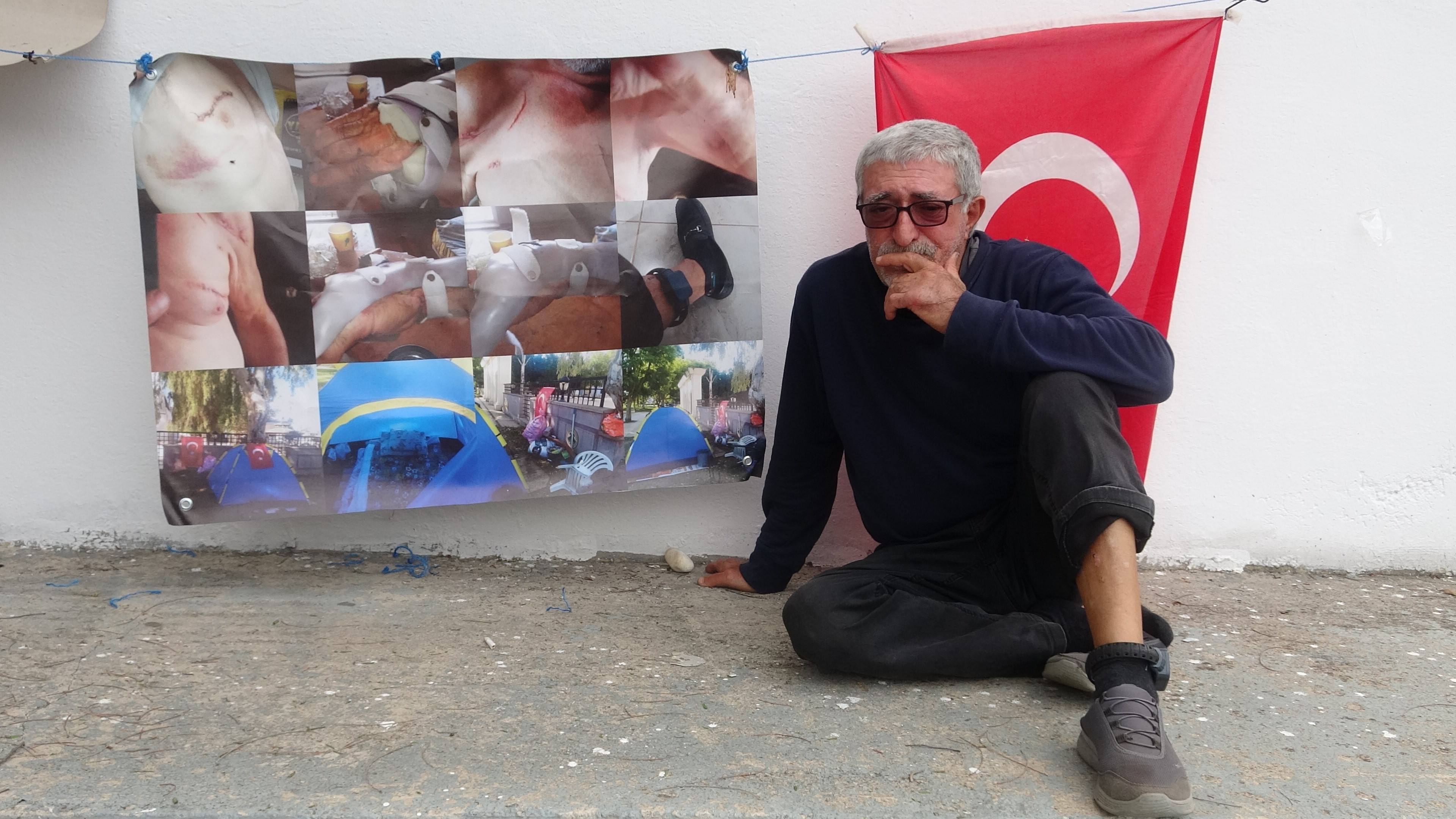 Affettiği Eşi Hayatını Kararttı Eşi Tarafından Bıçaklandı, Affetti, Şimdi Çadırda Yaşıyor (9)