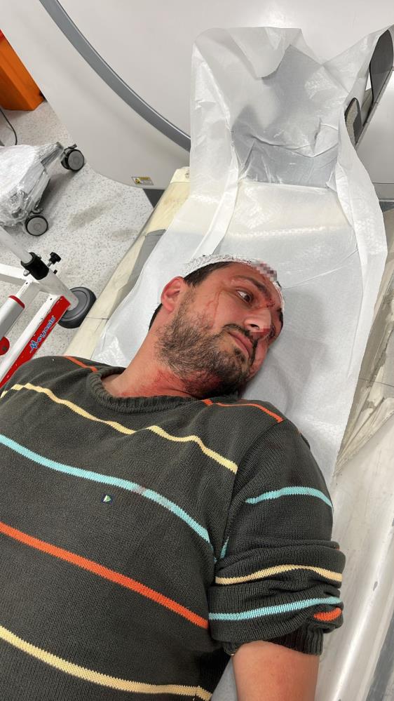 Bu Cinayete Tesebbus Otizmli Ve Epilepsi Hastasi Gence Odunla Saldiri (2)