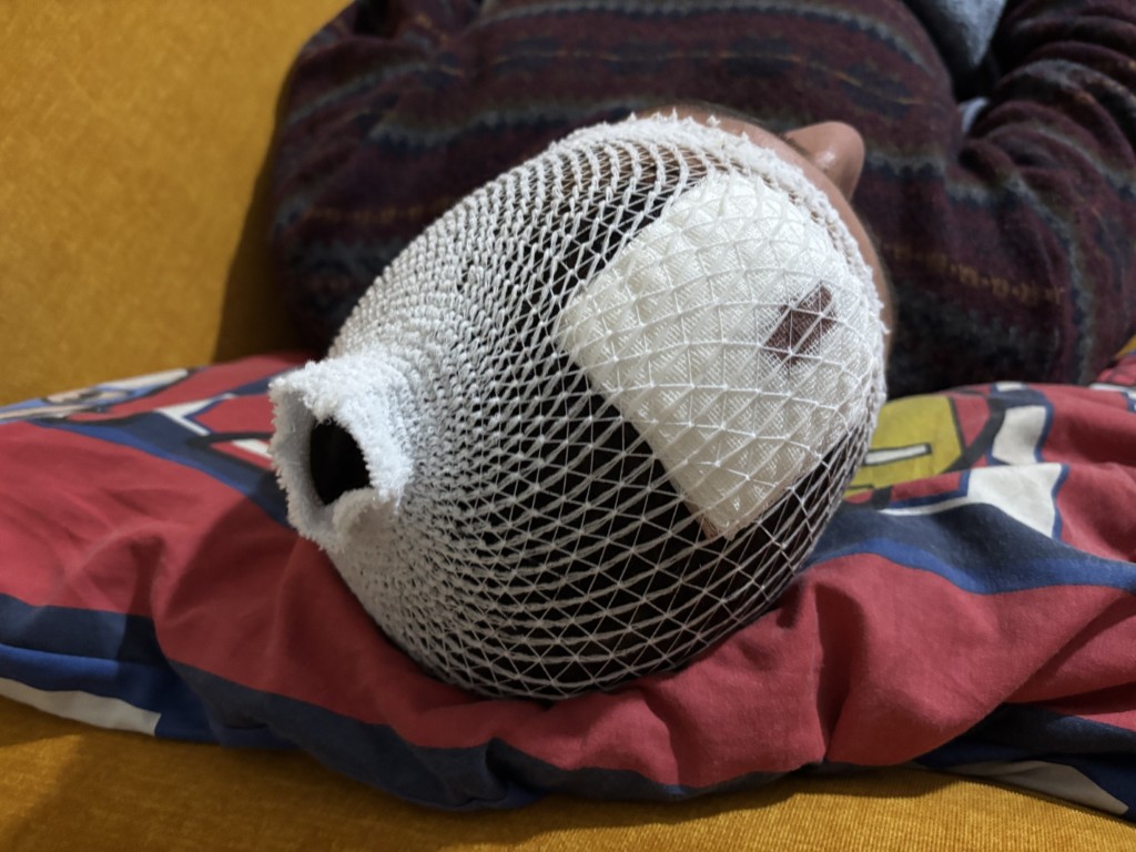 Bu Cinayete Tesebbus Otizmli Ve Epilepsi Hastasi Gence Odunla Saldiri (4) (Orta)