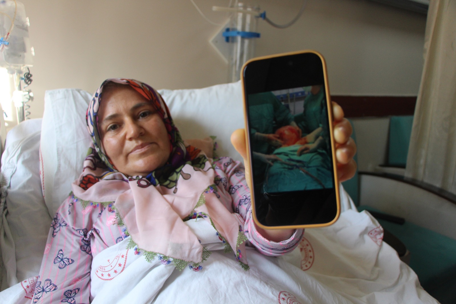 Doktorlar Bile Sasirdi Kadinin Karnindan Karpuz Kadar Kitle Cikti A