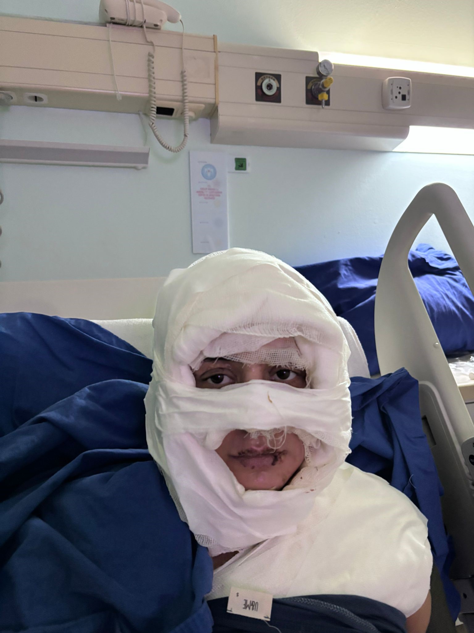 Eğlence Mekanı Önünde Dehşet Kadının Üzerine Yanıcı Madde Dökerek Ateşe Verdi (4)