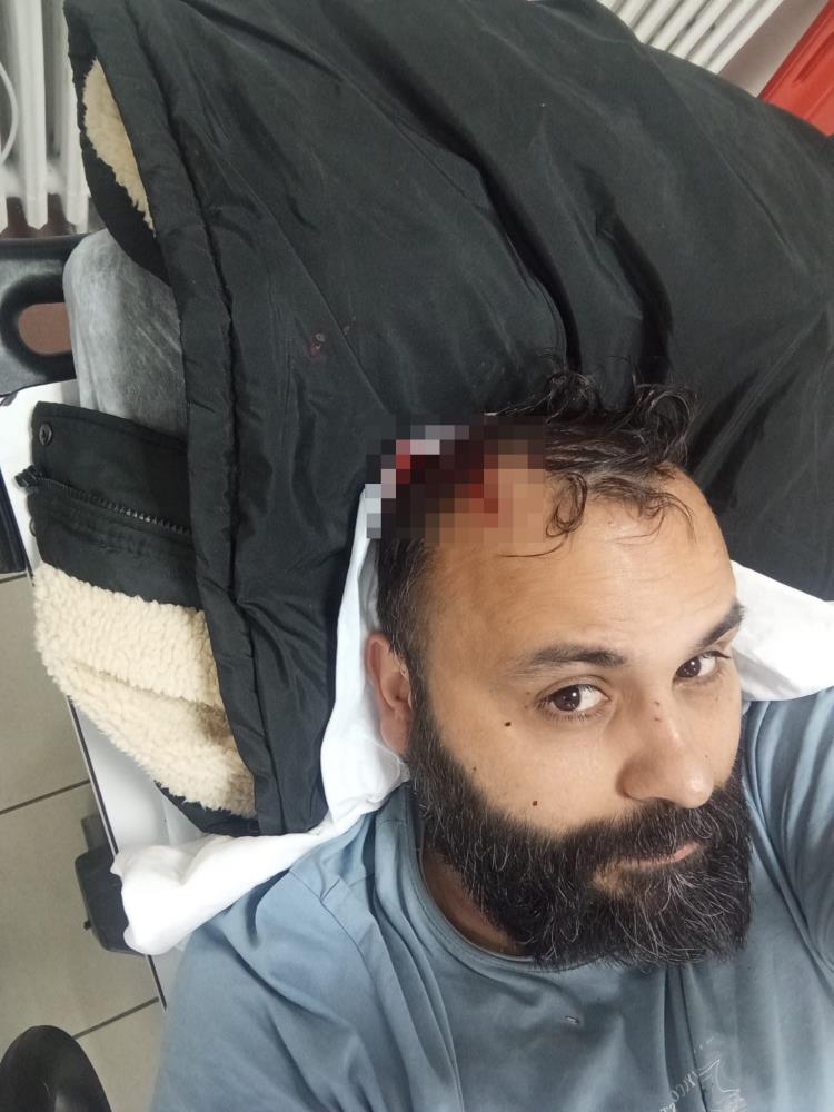 Kacamazsin Diyerek Saldirdilar Bosanma Krizi Kanli Bitti Kukla Sanatcisi Ve Oglu Hasta (1)-1