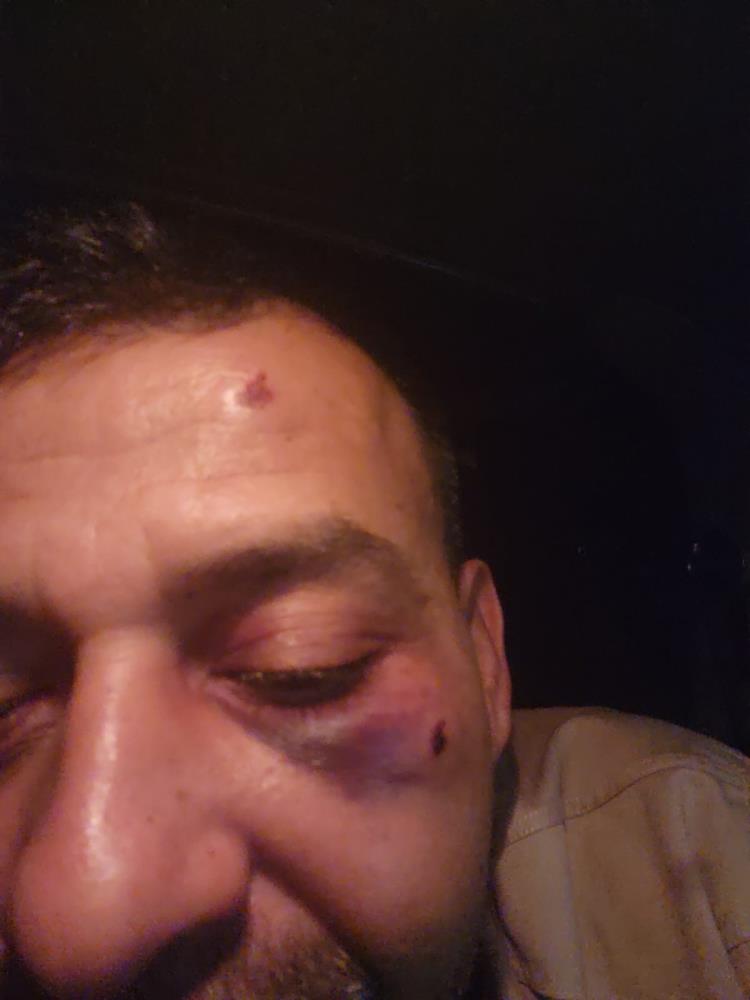 Kacamazsin Diyerek Saldirdilar Bosanma Krizi Kanli Bitti Kukla Sanatcisi Ve Oglu Hasta (5)