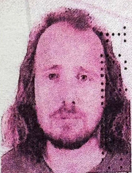 Saç Ekimi Ve Diş Tedavisi Sonrası Ölüm Polis Soruşturma Başlattı (2)