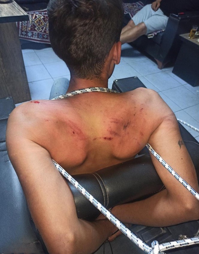 Hamam Böceği Yedirdiler, Bağladılar, Darp Ettiler Mahkemeden Tartışmalı Karar (4)