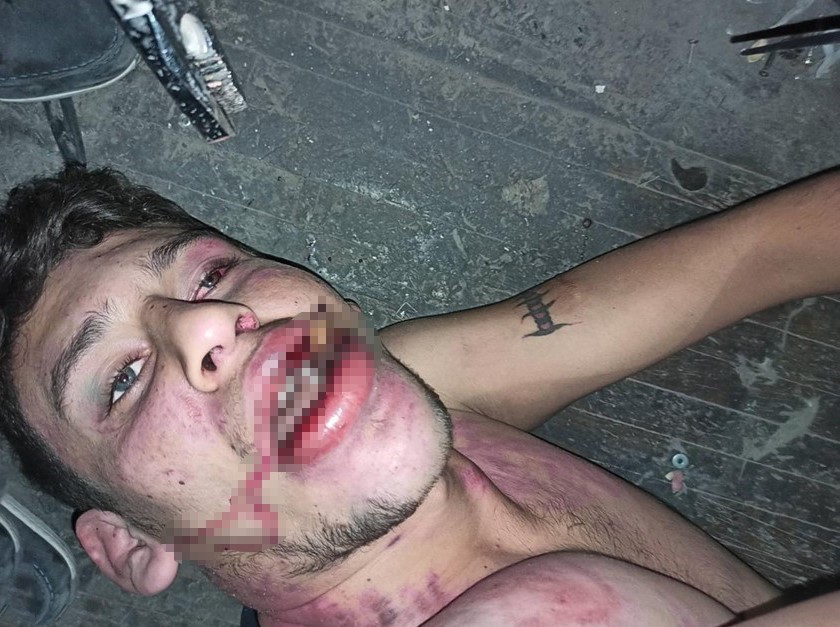 Hamam Böceği Yedirdiler, Bağladılar, Darp Ettiler Mahkemeden Tartışmalı Karar (6)