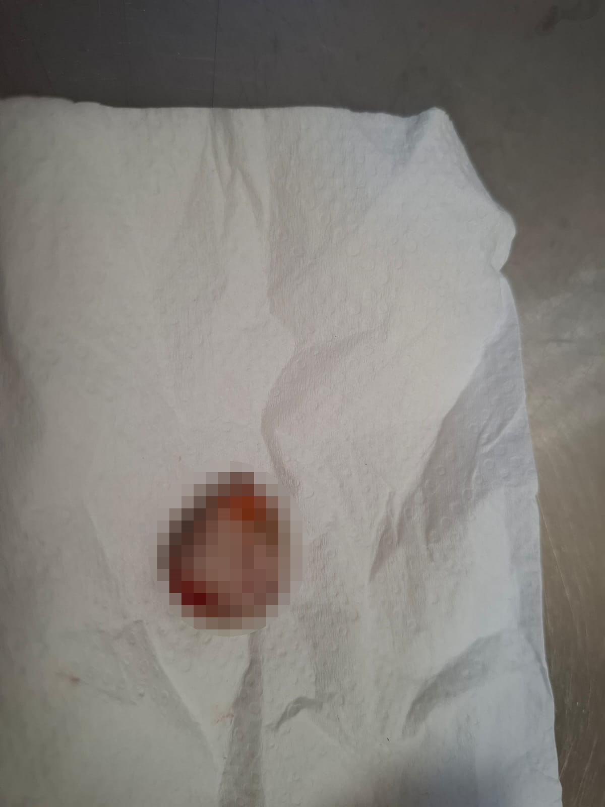 Kopan Parmağını Buzda Sakladı, 600 Kilometre Yol Geldi 14 Saat Sonra Mucize (2)