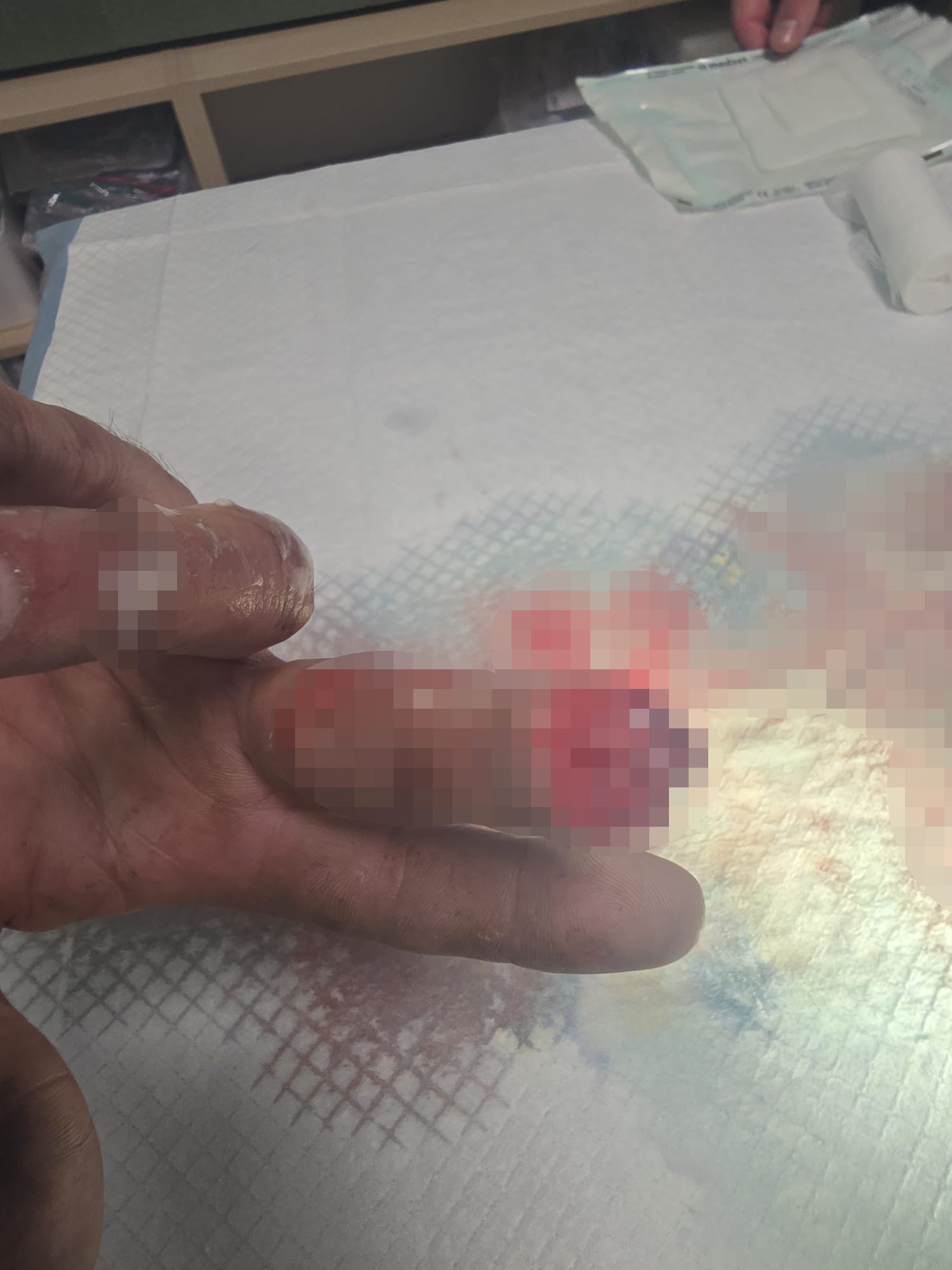 Kopan Parmağını Buzda Sakladı, 600 Kilometre Yol Geldi 14 Saat Sonra Mucize (3)