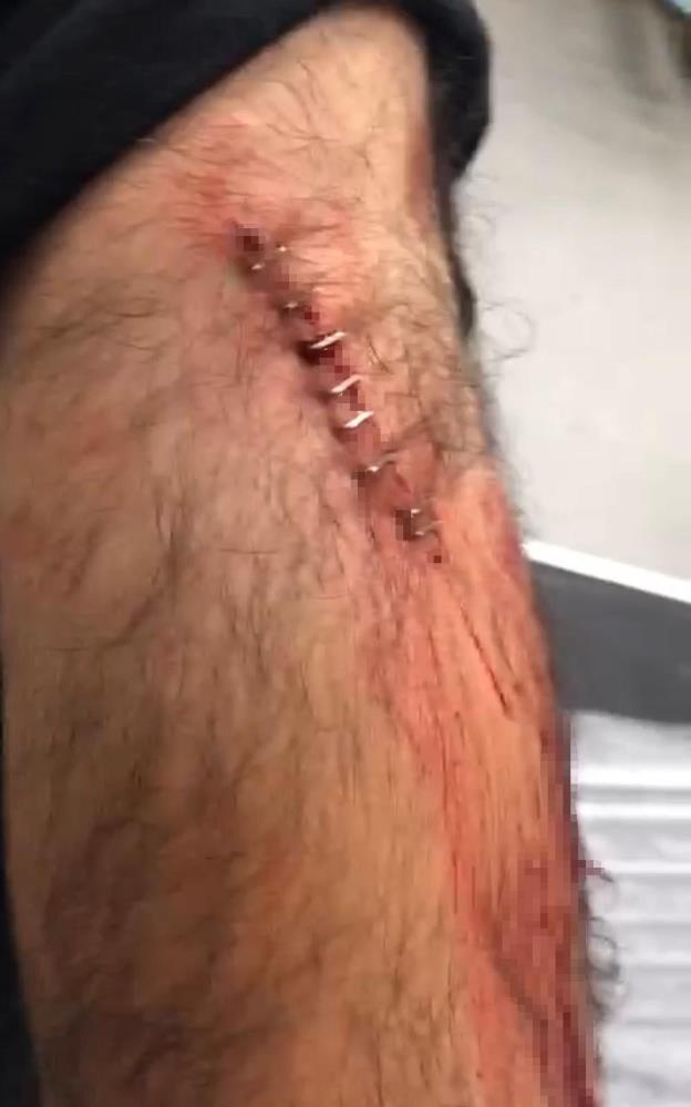 Ogretmene Sokak Ortasinda Jiletli Saldiri Para Vermeyince Yaralandi (1)